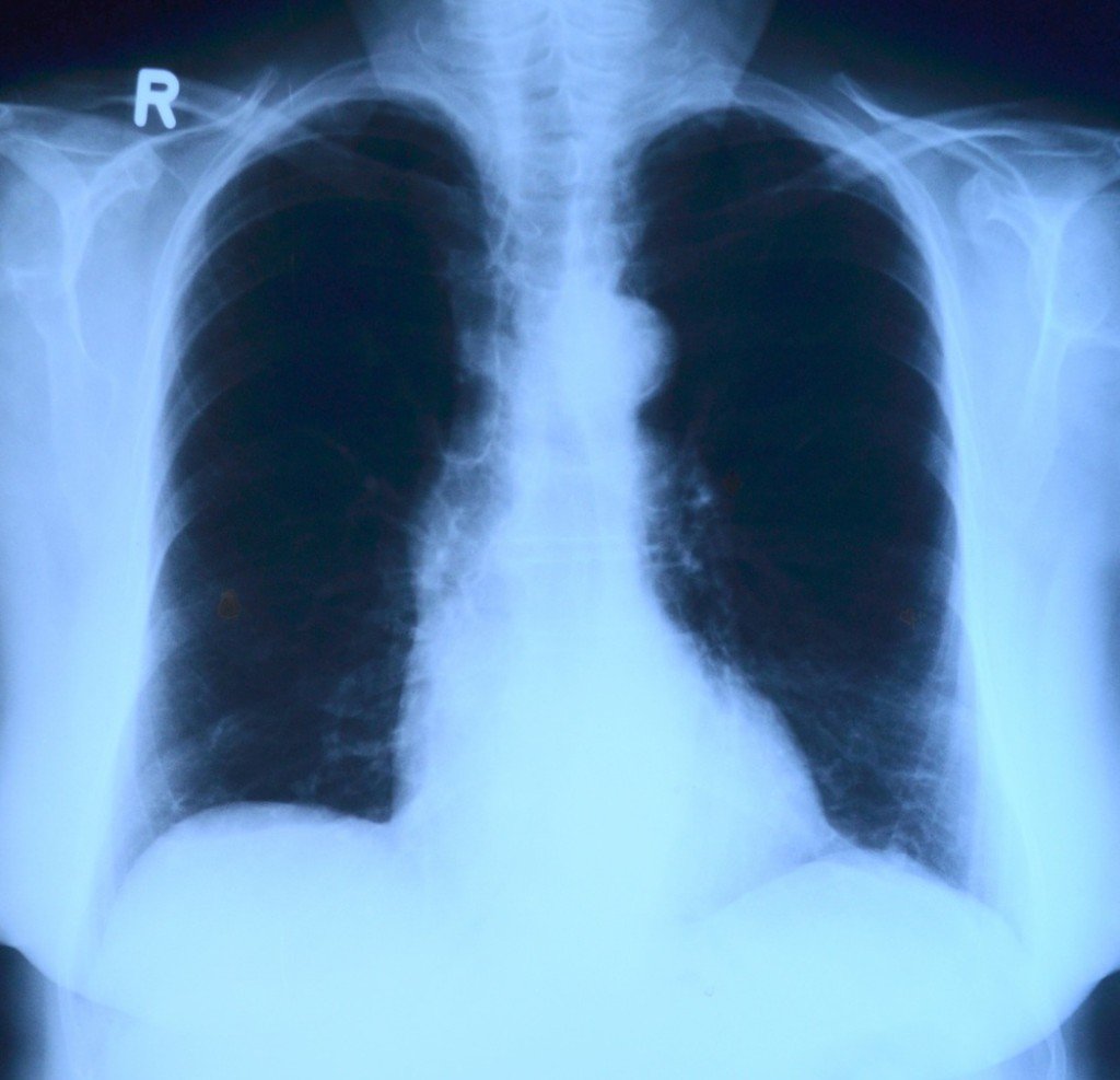 md radiology admission